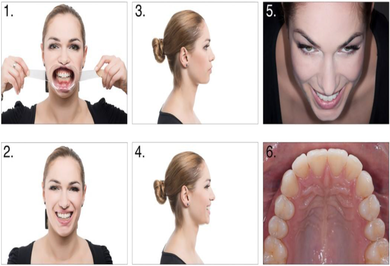 Smile Design Workflow