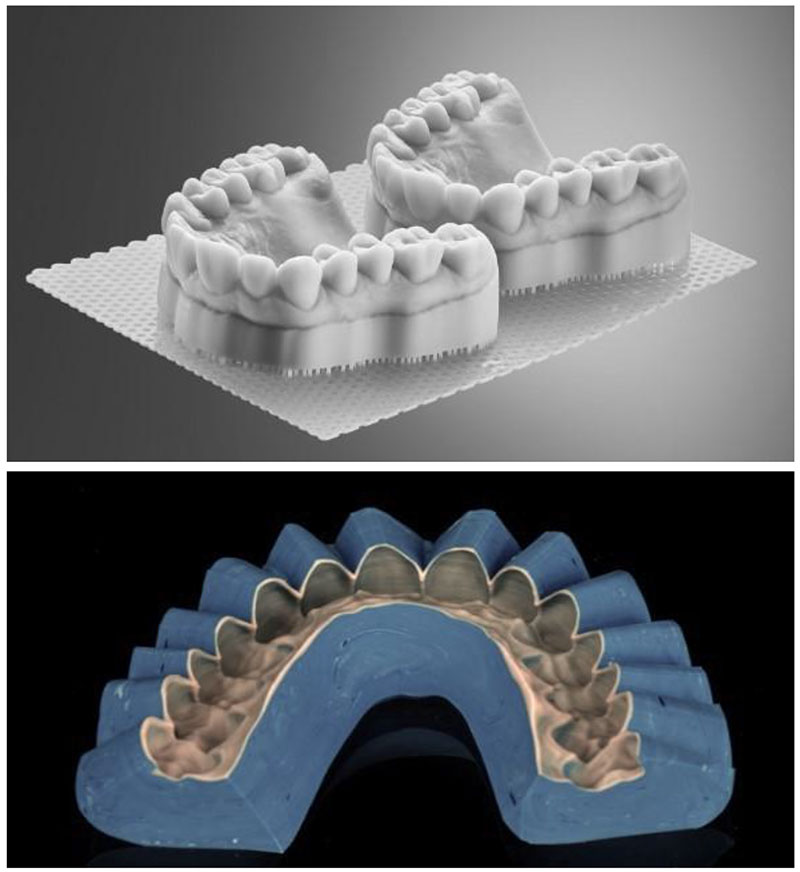 Dental Implants